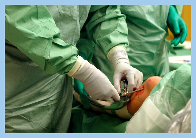The doctor operates Ronja's knee.